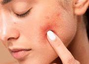 Kulit Sensitif? Ini Dia Tips Memilih Serum Wajah yang Tepat